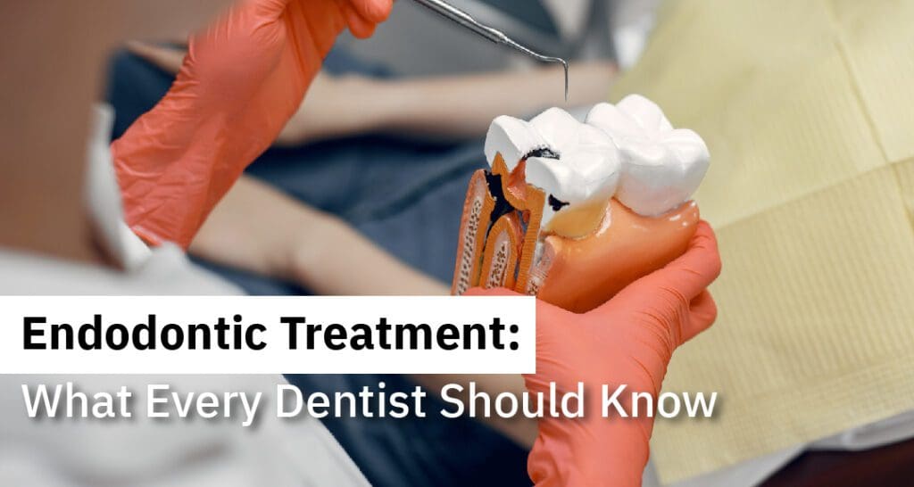 Endodontic Treatment: What Every Dentist Should Know